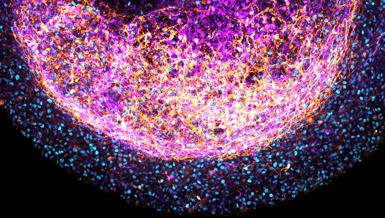 brain